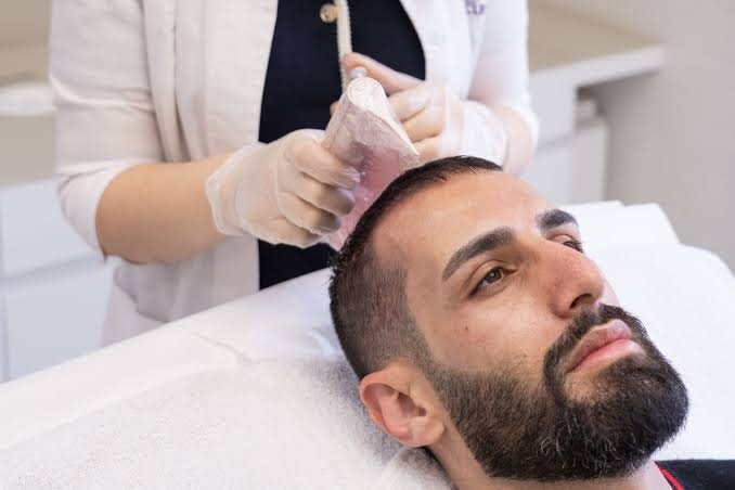 Hair Transplant in Lahore