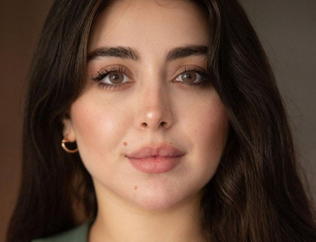 Lip Fillers: What to Know Before Considering Lip Enhancement