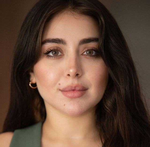 Lip Fillers: What to Know Before Considering Lip Enhancement
