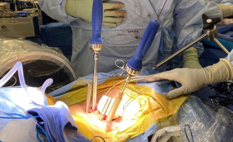Minimally Invasive Spine Surgery Al Ain: Benefits & Care