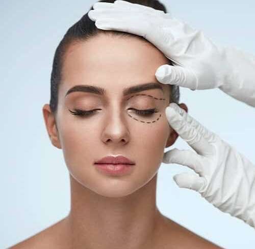 Blépharoplastie à Paris : Redonnez de la fraîcheur à votre regard