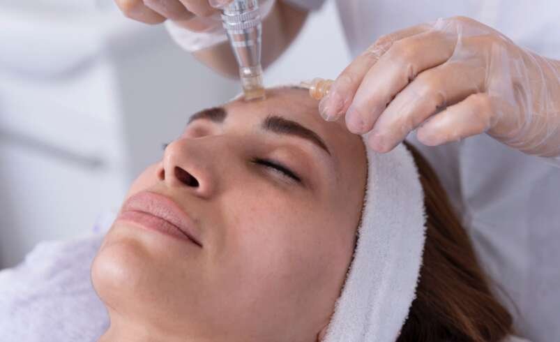 Microneedling Therapy in Liverpool: Support Smoother, Healthier-Looking Skin