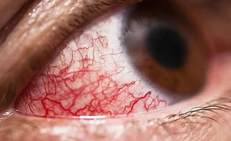 Best Retina Specialist in Delhi for Retinal Eye Conditions
