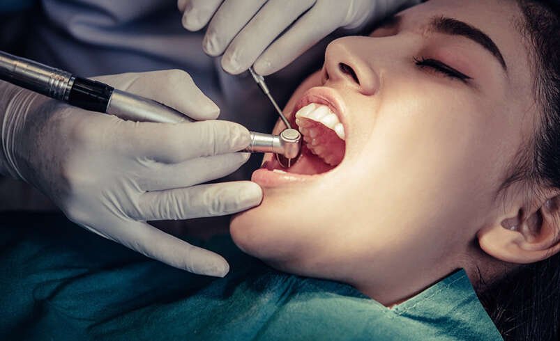 Dental Clinic in Thane West for Restorative Dental Care
