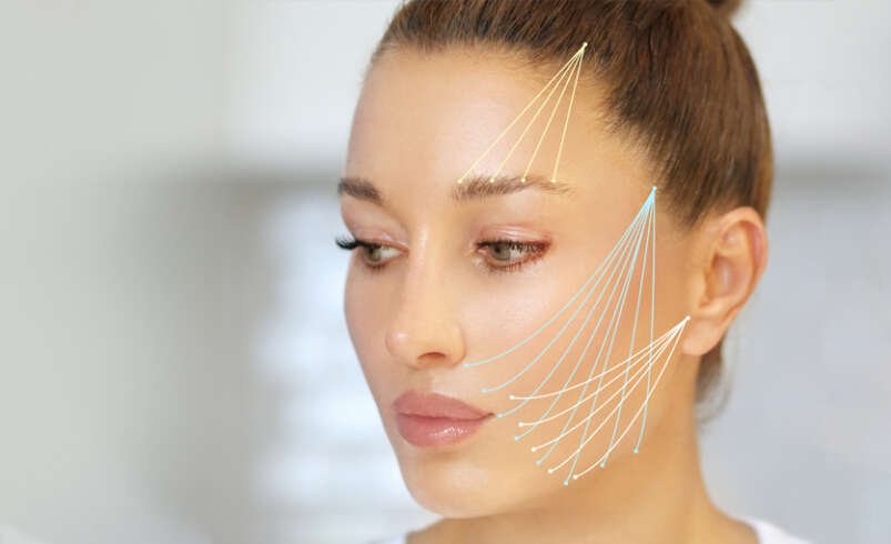 Facial Thread Lift in Dubai: Choosing the Right Treatment for Your Skin
