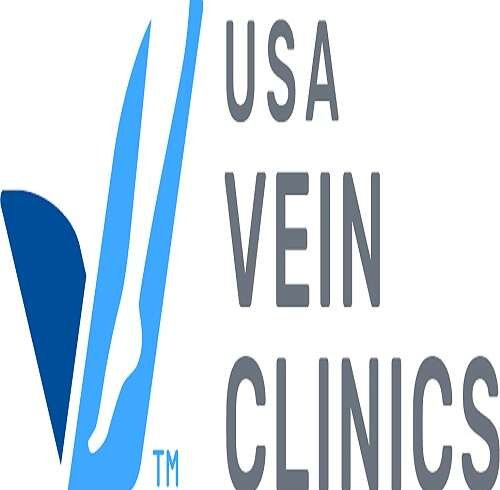 What to Expect When Visiting a Spider Vein Doctor